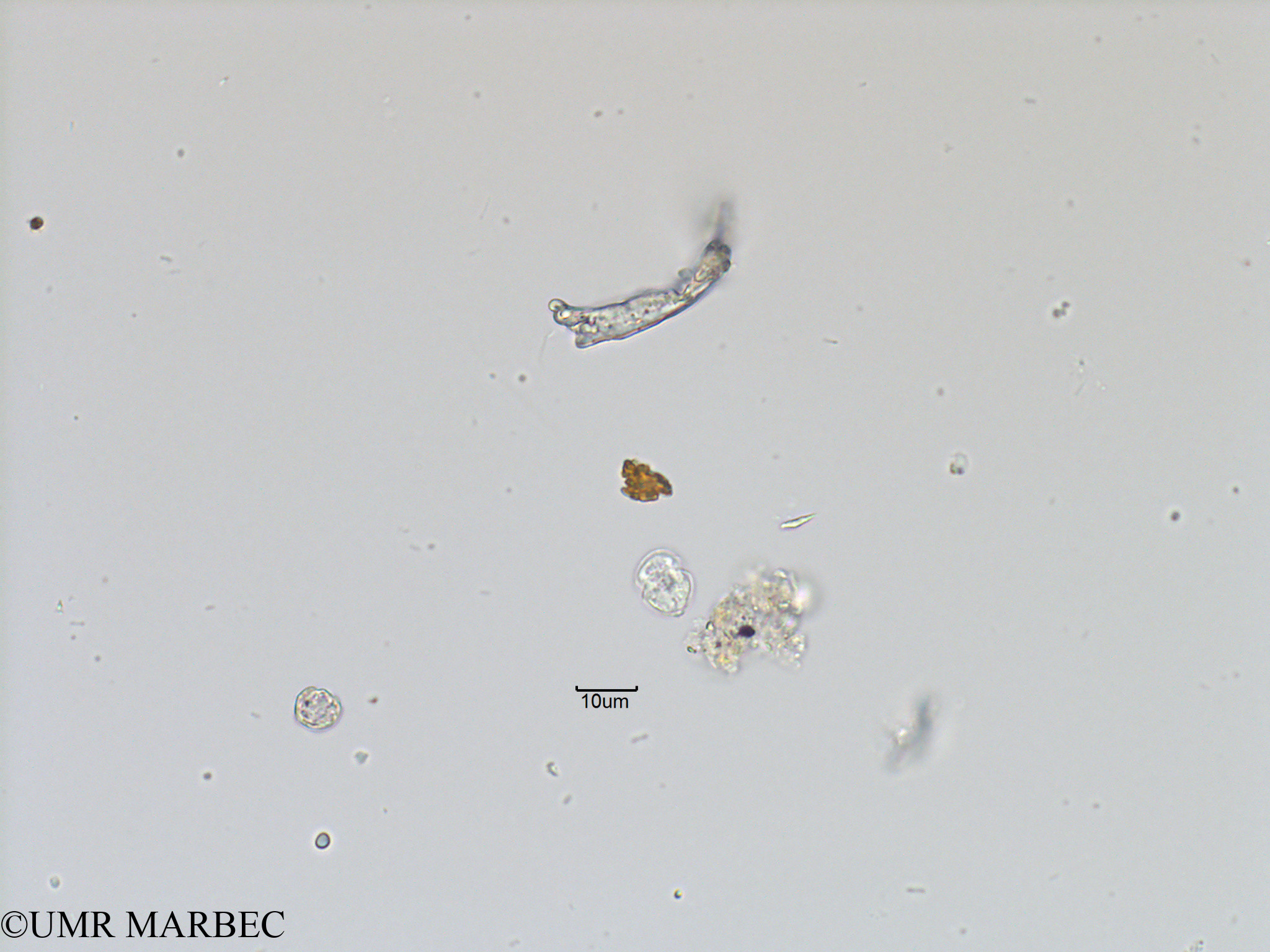 phyto/Bizerte/bizerte_bay/RISCO November 2015/Azadinium spp (Baie_T5-ACW1-Petit dino- cf heterocapsa minima ou azadinium-1).tif(copy).jpg